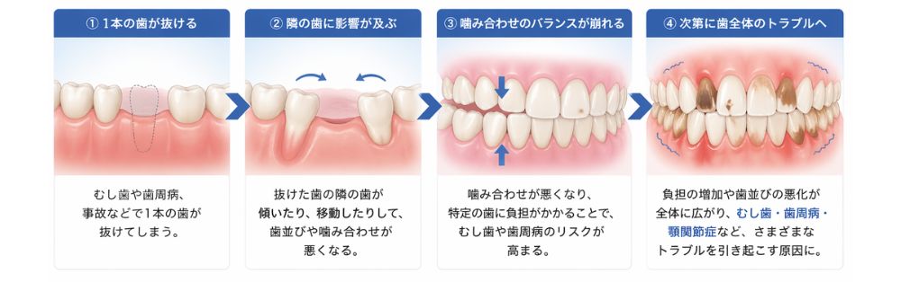 お口の中はチームワークで動いています