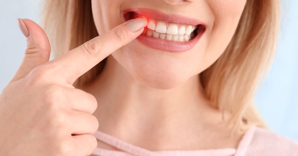 お口の中はチームワークで動いています