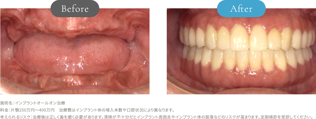 症例集