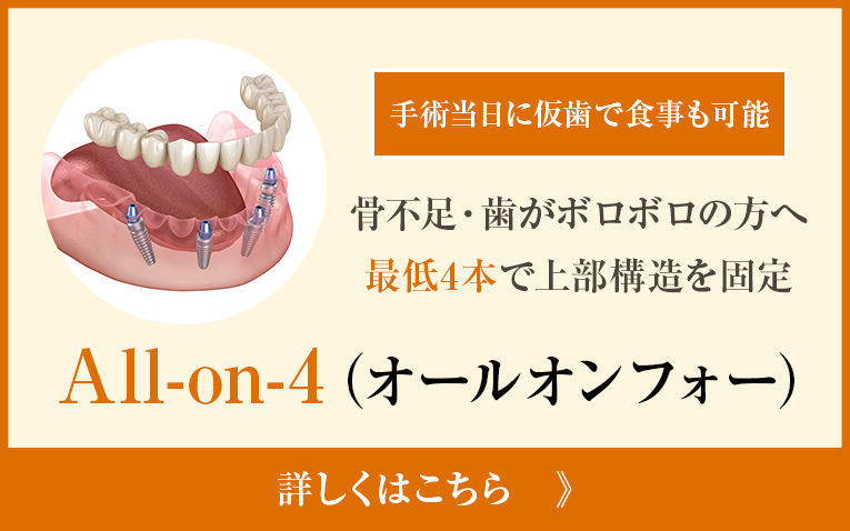 オールオンフォー