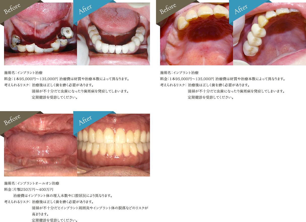 症例集