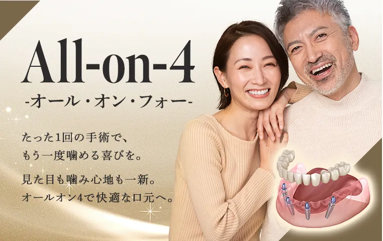 オールオン4(オールオンフォー)とは|特徴・治療の流れを解説【福岡・博多】