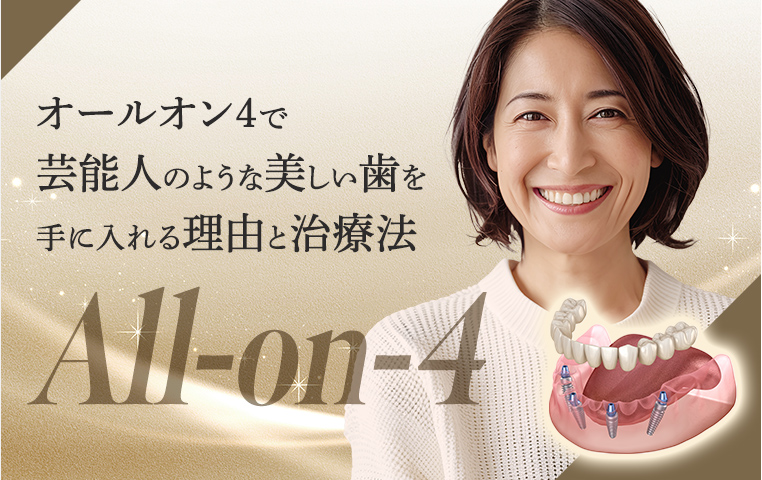 オールオン4で芸能人のような美しい歯を手に入れる理由と治療法