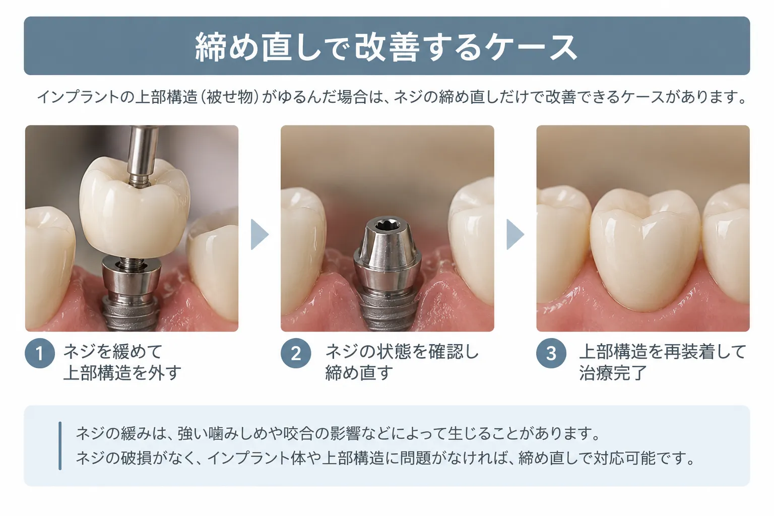 締め直しで改善するケース