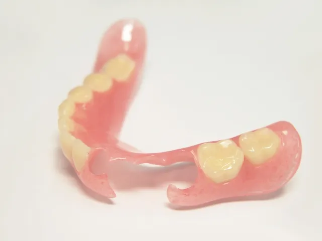 残っている歯を利用した部分入れ歯