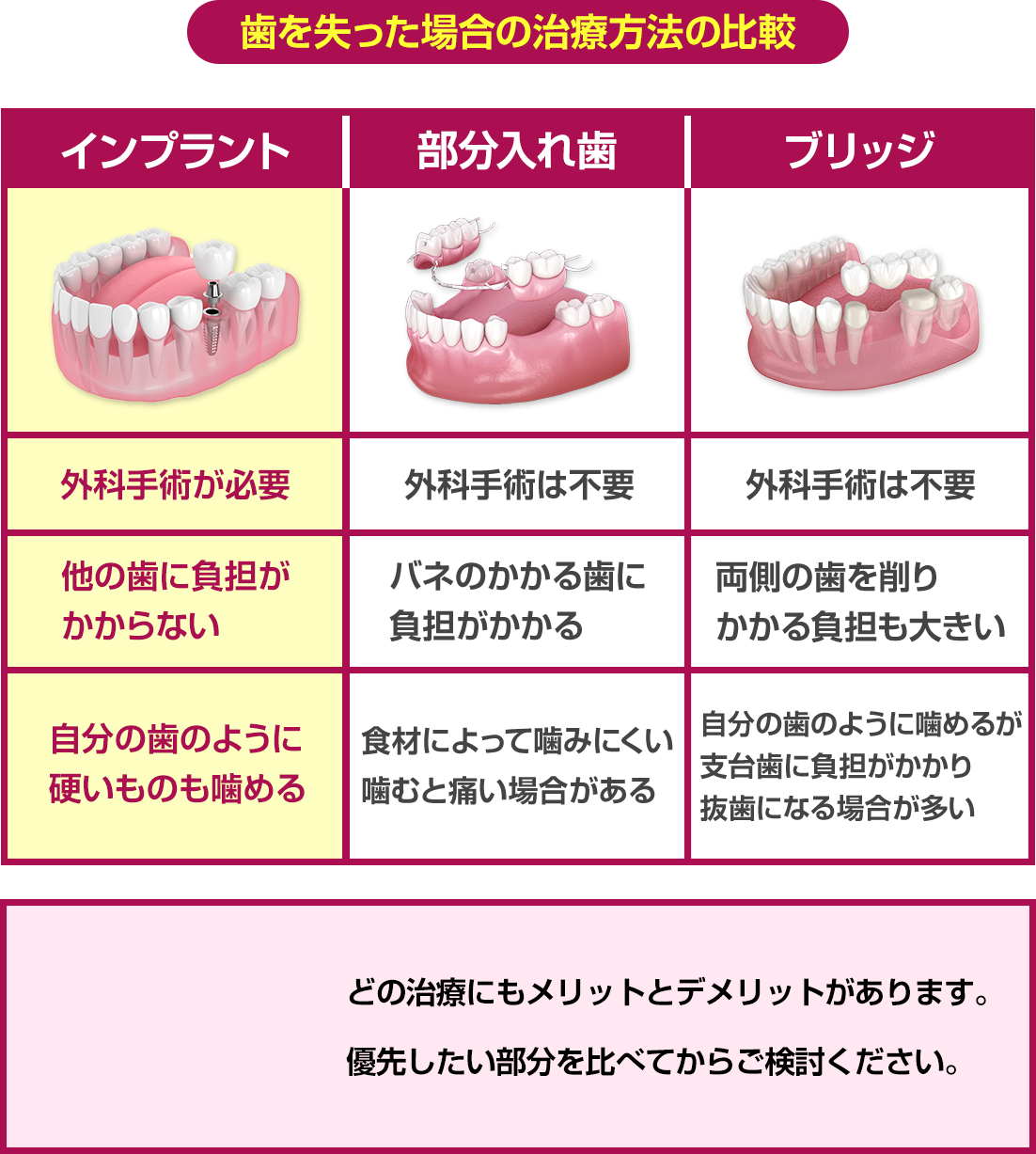 歯を失った場合の治療方法の比較