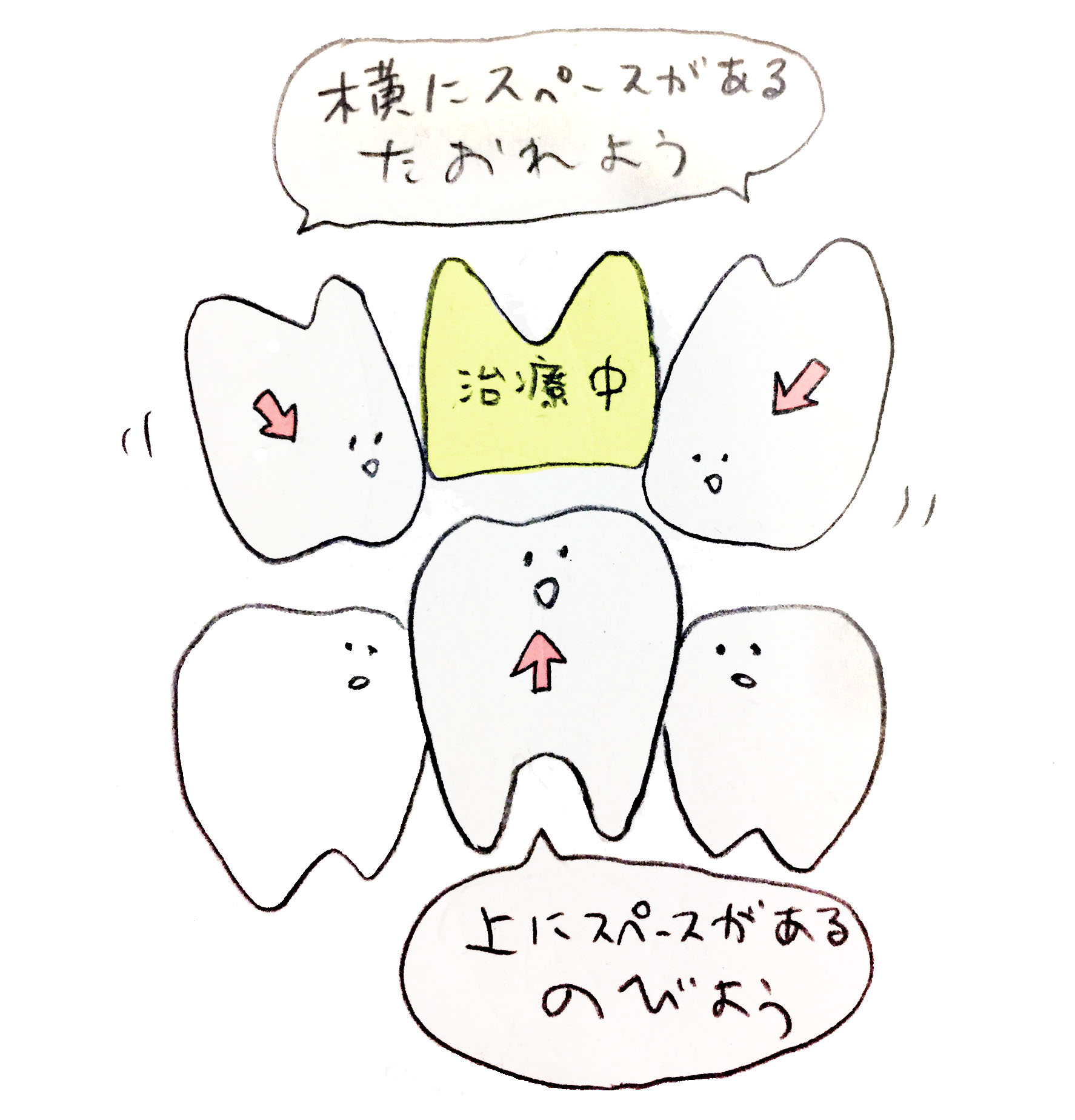 歯は移動したり伸びたりしてします ザ・インプラントクリニック福岡