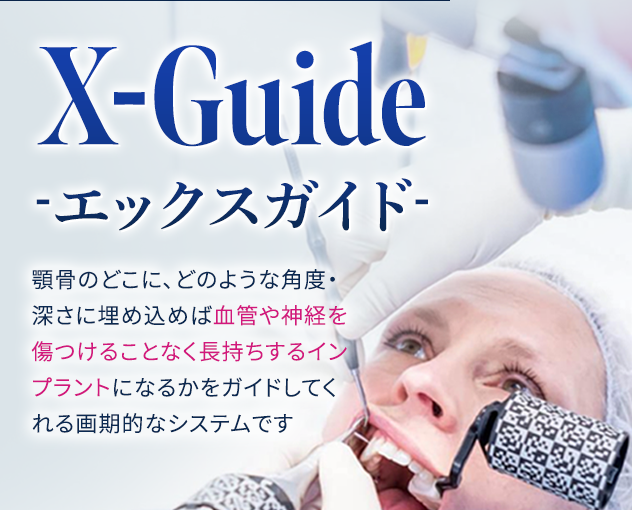 インプラント治療の安全性を高めるサージカルガイド X-ガイド