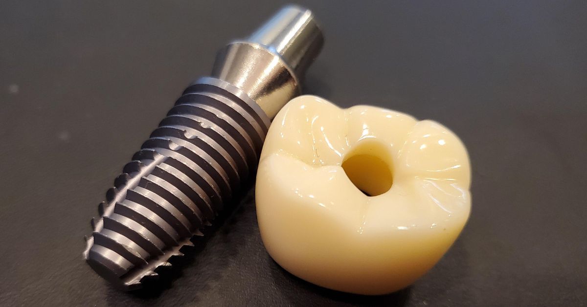 ③治療後のメンテナンス・保証が不十分