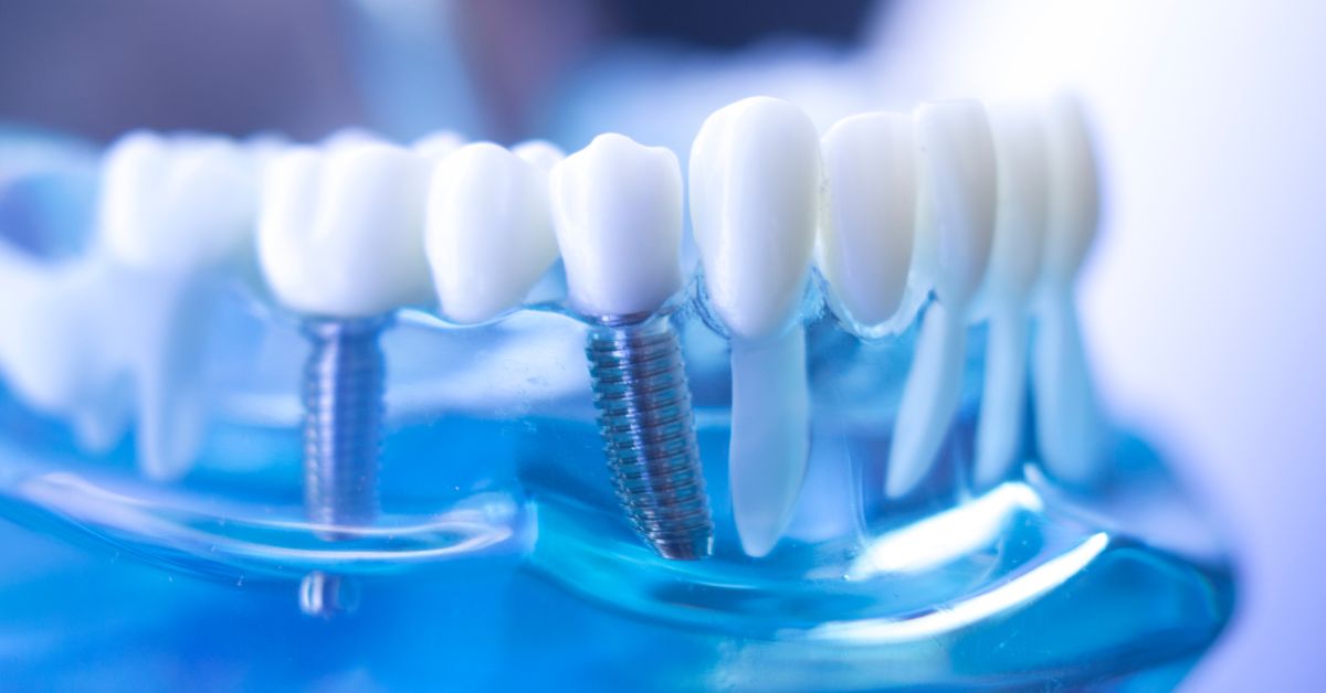 骨がないから無理と断られた方へ。諦める前に知るべき3つの解決策