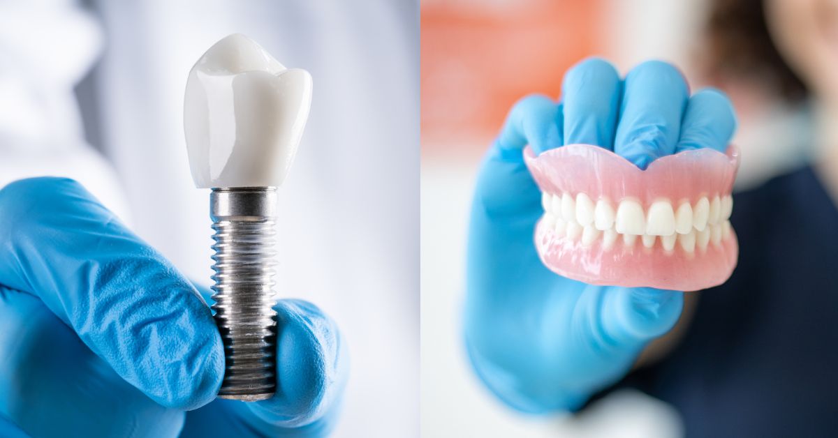 【結論】インプラント vs 入れ歯どっちがいい?費用・寿命・後悔する人の3つの違い